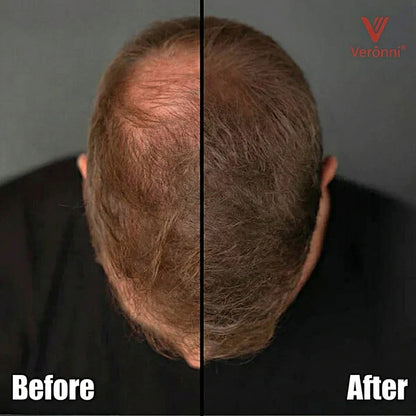 Verônni® Premium Hair Fibers (Hair & Beard)