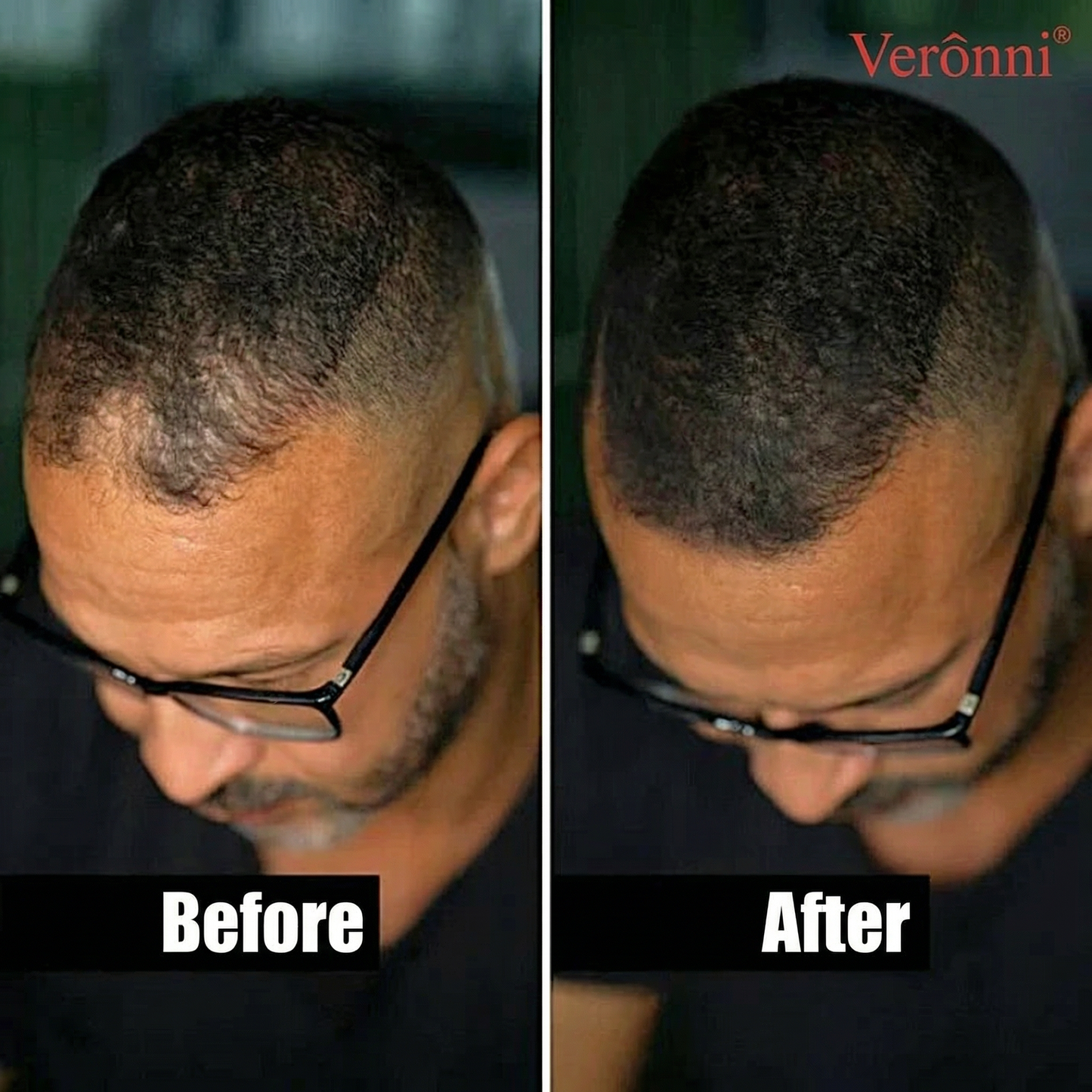 Verônni® Premium Hair Fibers (Hair & Beard)