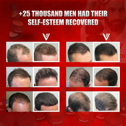 Verônni® Premium Hair Fibers (Hair & Beard)